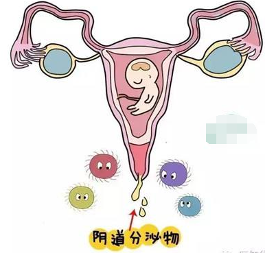 阴道分泌物检测仪的一般性状检查类型