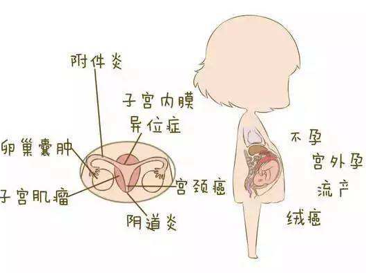 阴道分泌物检测仪分析阴道炎早期症状