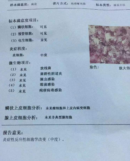 阴道分泌物检测仪厂家教你查看阴道分泌物检测报告