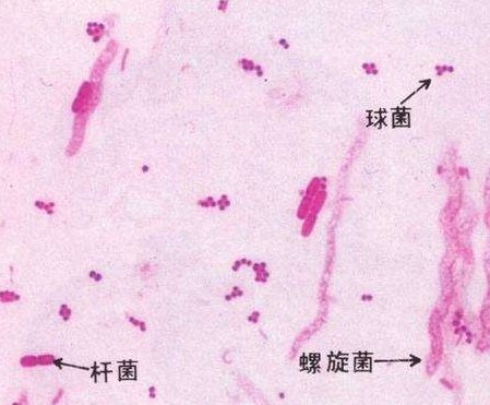 妇科白带检测仪厂家分析白带线索细胞阳性的意义