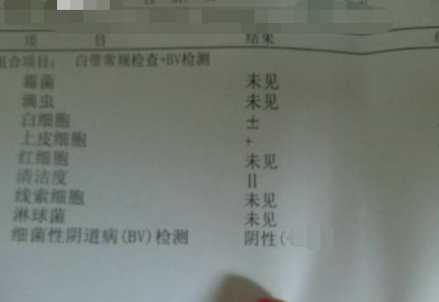 全自动白带分析仪分享如何看懂白带常规检测报告单