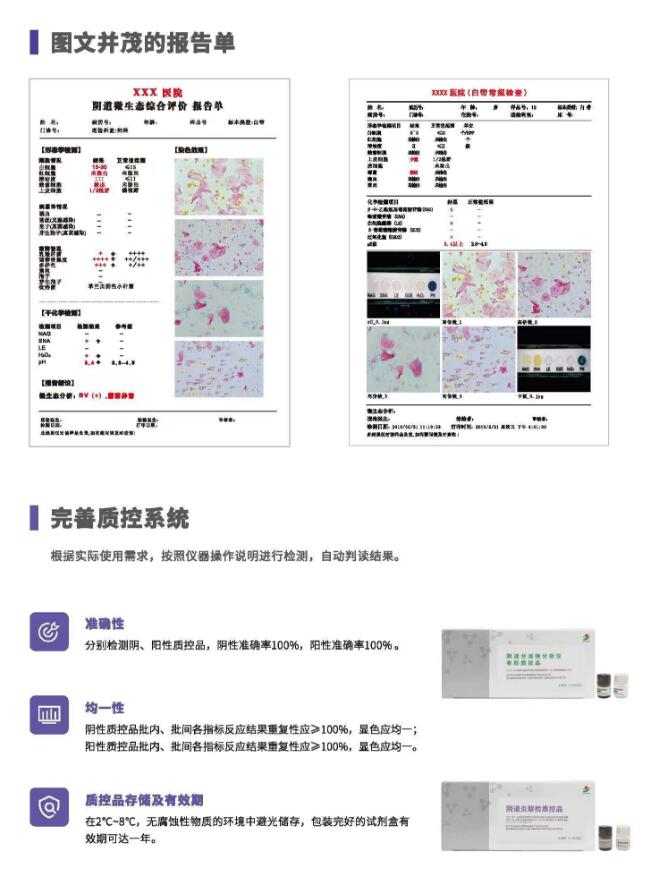 阴道分泌物分析仪V800报告单