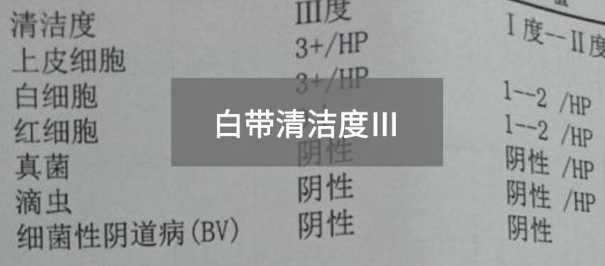 今天快讯！全自动白带分析仪生产厂家国康为您官方解释白带清洁度3的意思